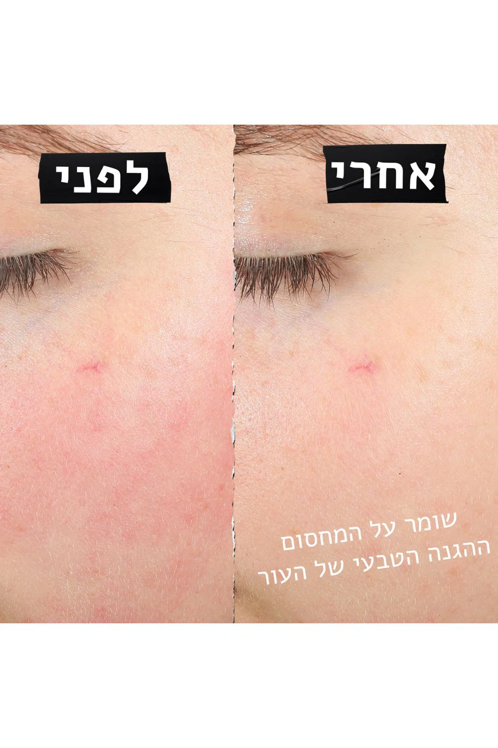 קרם פנים משקם לעור רגיש 28 מ"ל | קיל'ס - Image 4