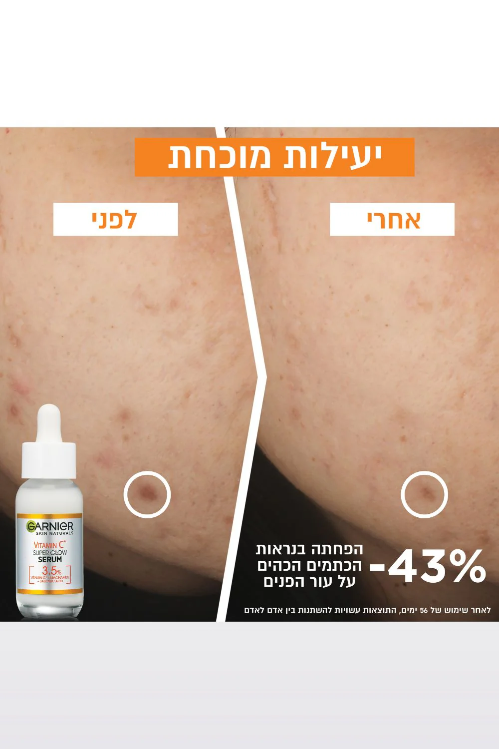 SKIN ACTIVE סרום לפנים ויטמין C - Image 4