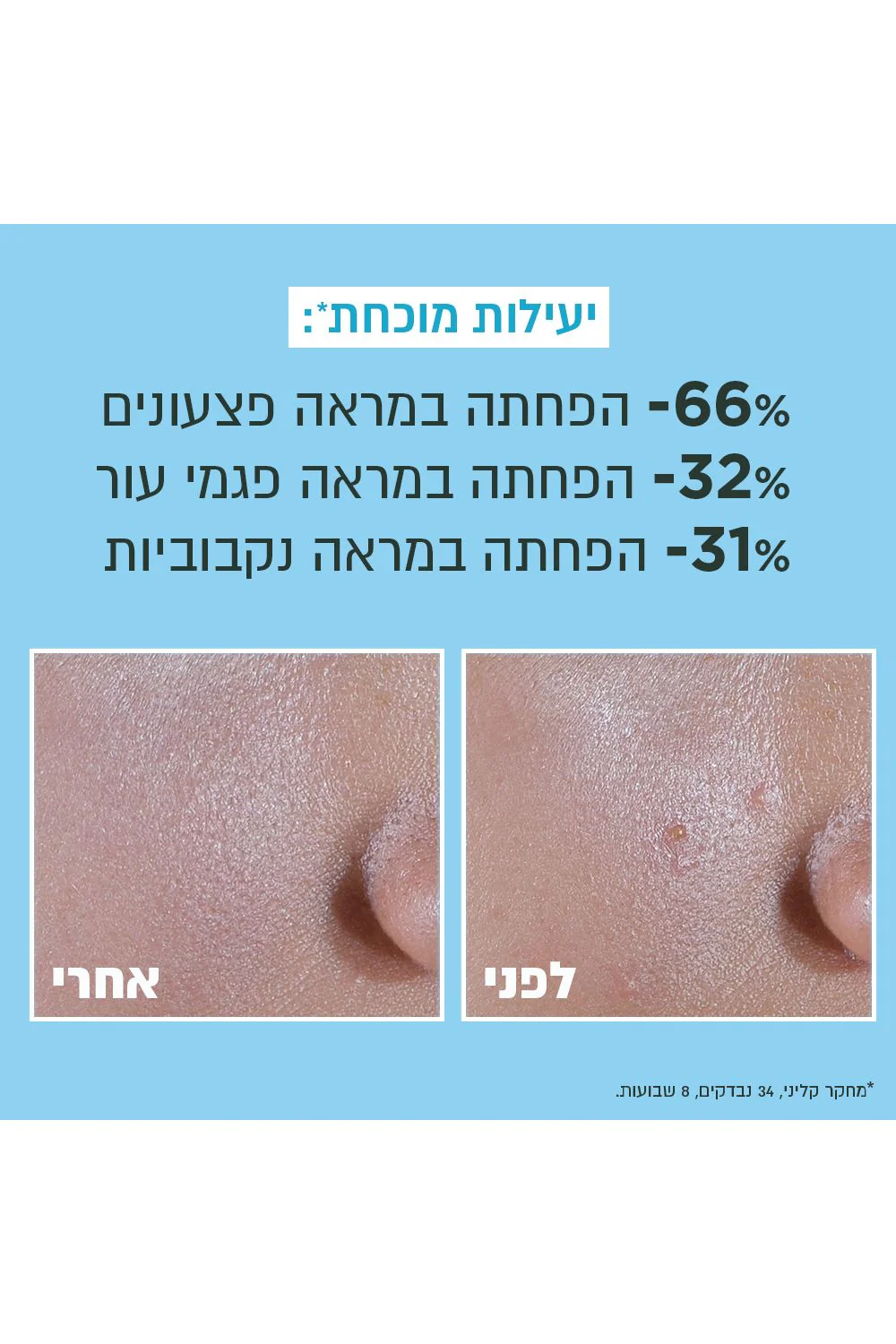 תחליב לחות UV ניאצינאמיד 40 מ"ל - Image 3